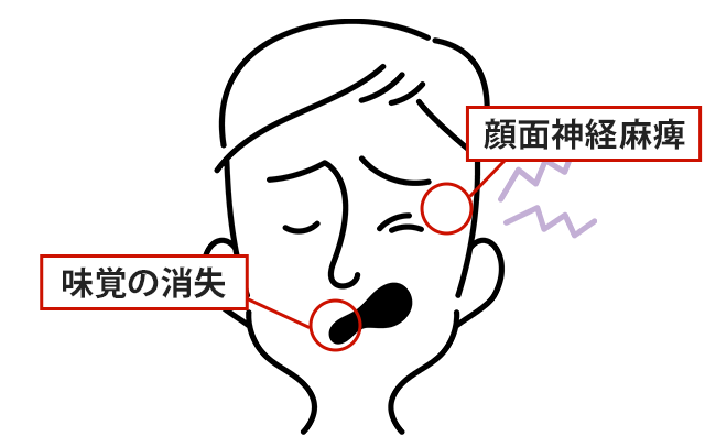 症状の該当箇所のイラスト