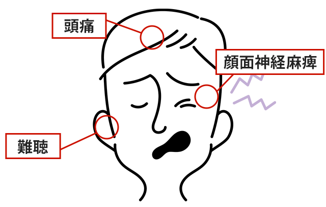 症状の該当箇所のイラスト