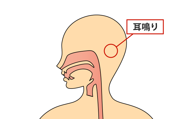 症状の該当箇所のイラスト