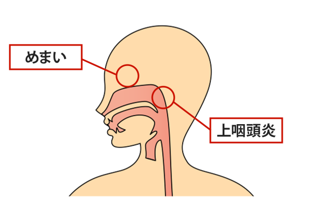 症状の該当箇所のイラスト